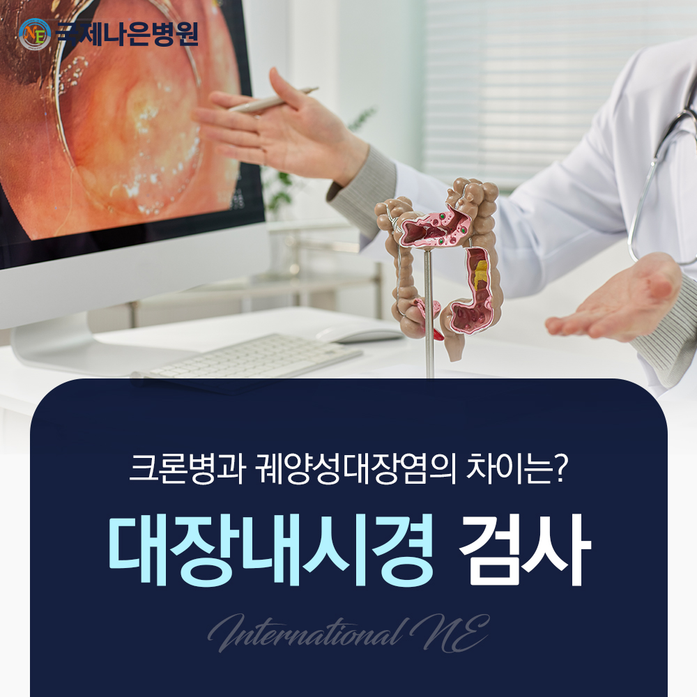 안양대장내시경 검사, 크론병과 궤양성대장염의 차이