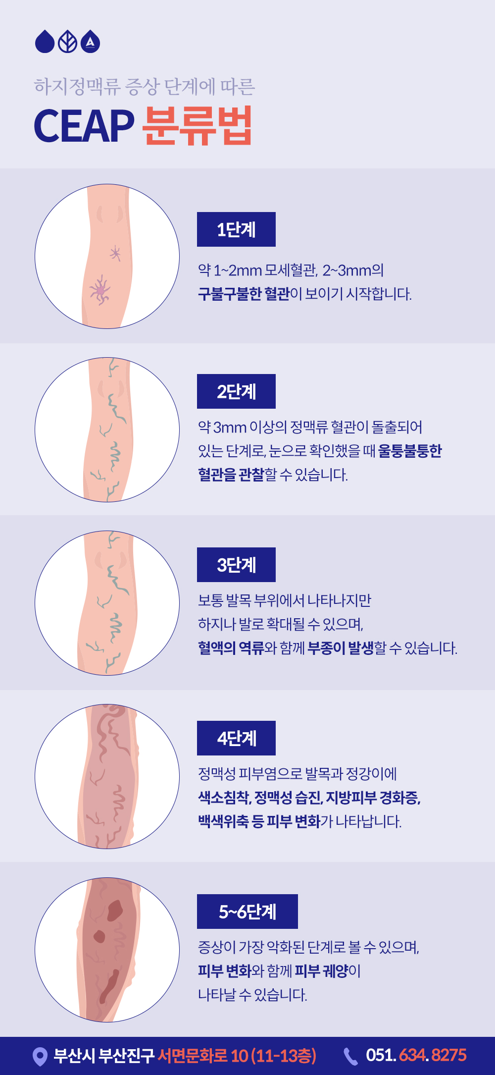 서면혈관초음파 다리 저림과 통증이 지속될 때 필요해요.