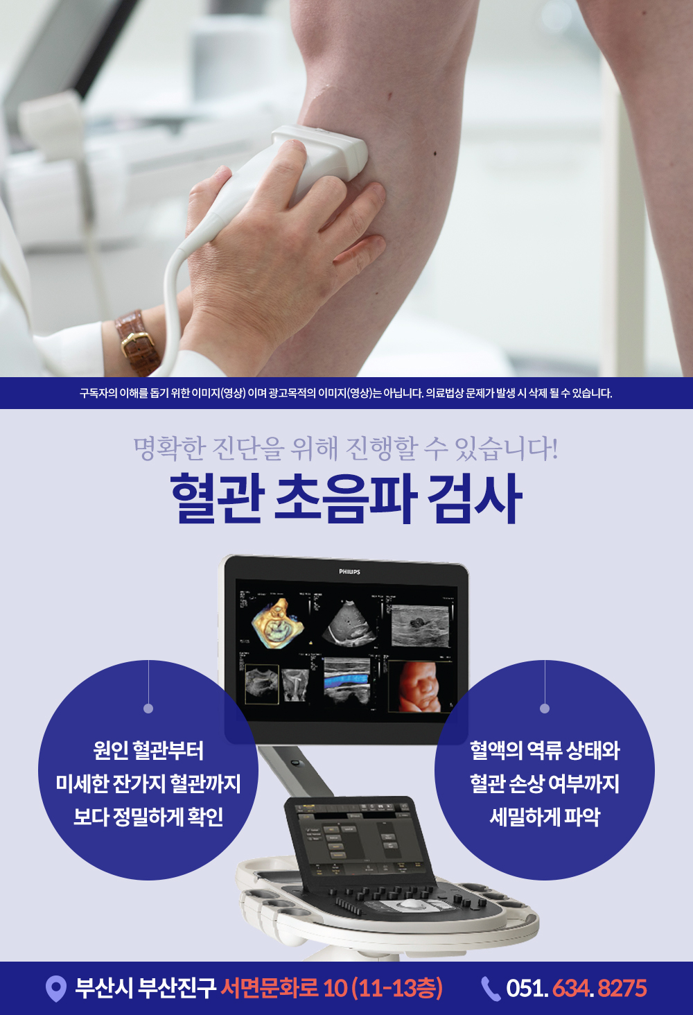 서면혈관초음파 다리 저림과 통증이 지속될 때 필요해요.